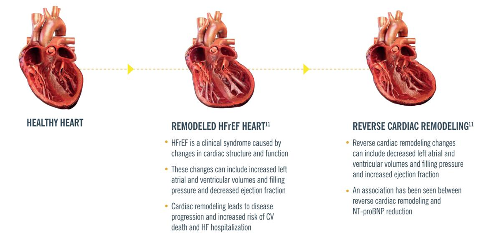 ENTRESTO page 3 img1 1.png
