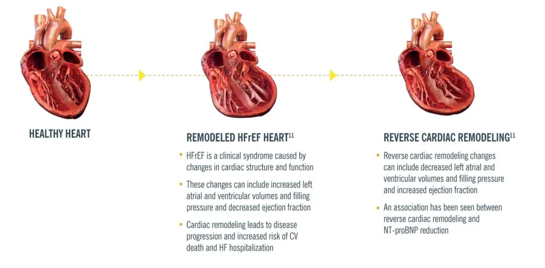 ENTRESTO page 3 img1 1.png