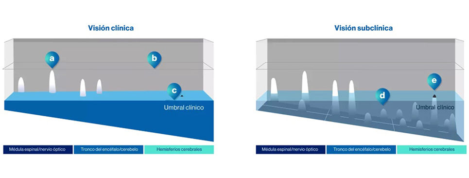 vision clinica vs vision subclinica