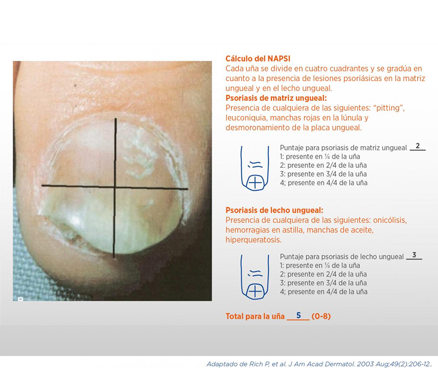 Diagnosticos_NAPSI Diagnosticos_NAPSI
