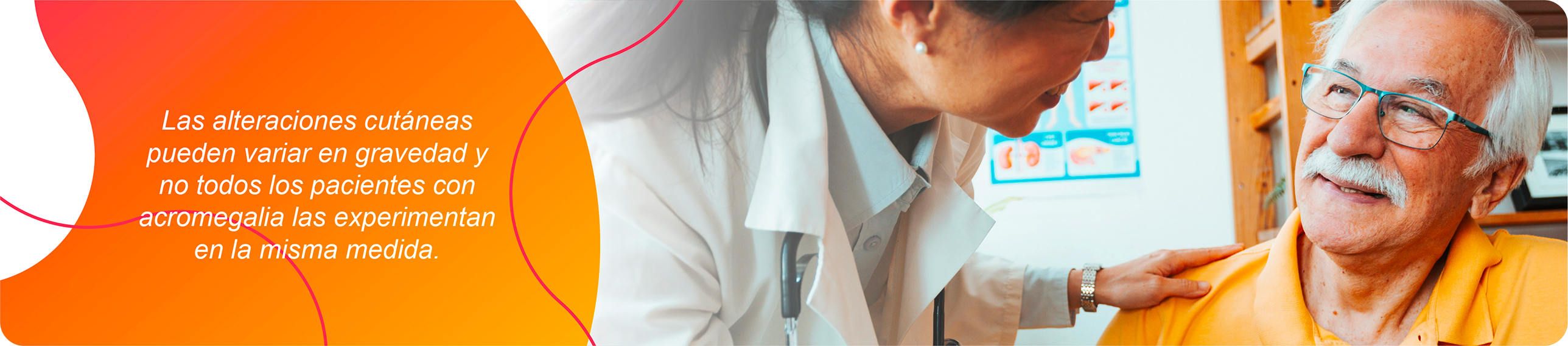 Las alteraciones cutáneas pueden variar en gravedad y no todos los pacientes con acromegalia las experimentan en la misma medida Las alteraciones cutáneas pueden variar en gravedad y no todos los pacientes con acromegalia las experimentan en la misma medida