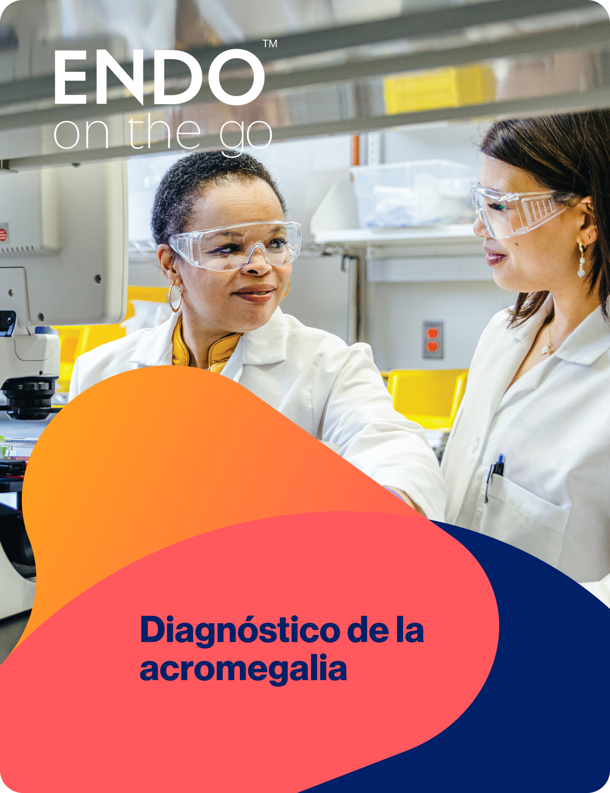 Acromegalia: Diagnóstico Acromegalia: Diagnóstico