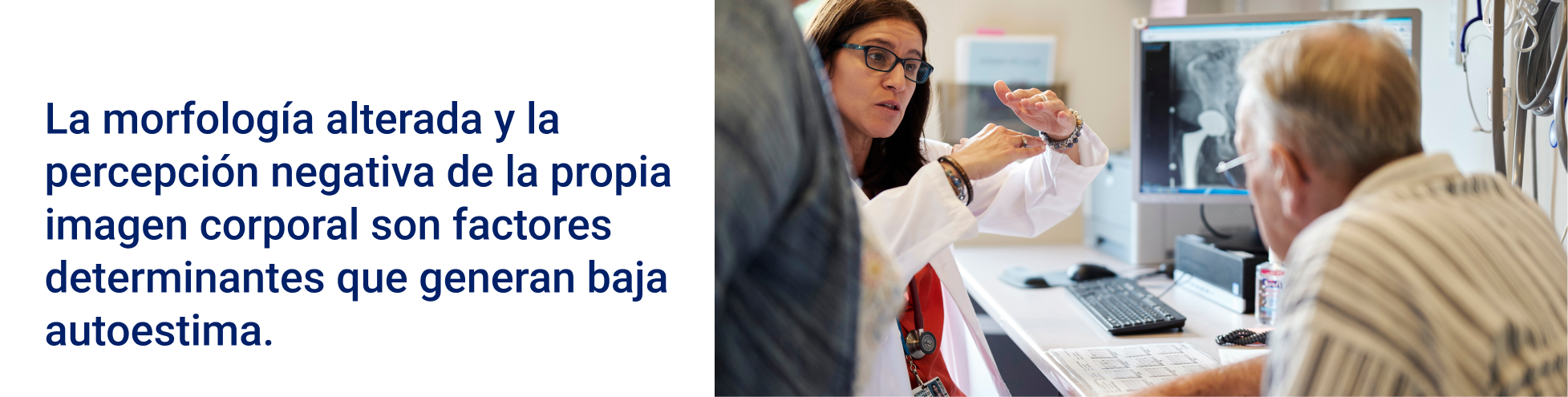 La morfología alterada y la percepción negativa de la propia imagen corporal son factores determinantes que generan baja autoestima.