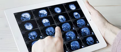 Neurologia_NoPromo_VentanaOportunidadLogo_Imagen