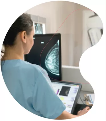 Oncotype DX® y el cáncer de mama