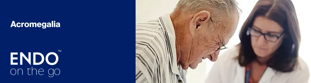 ¿Qué es la acromegalia?