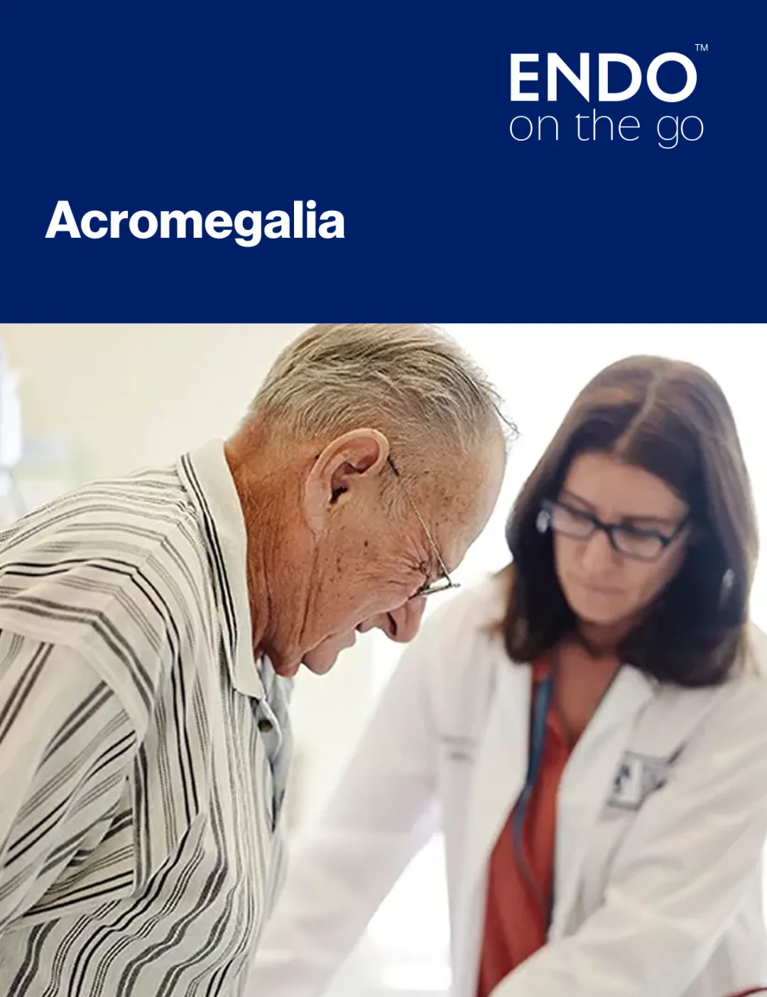¿Qué es acromegalia?