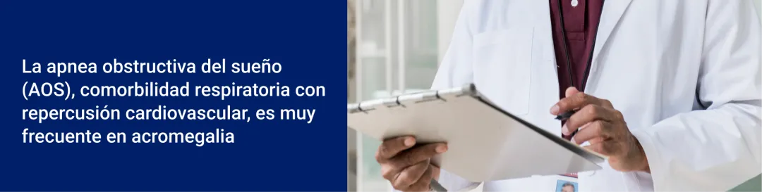 La apnea obstructiva del sueño (AOS), comorbilidad respiratoria con repercusión cardiovascular, es muy frecuente en acromegalia
