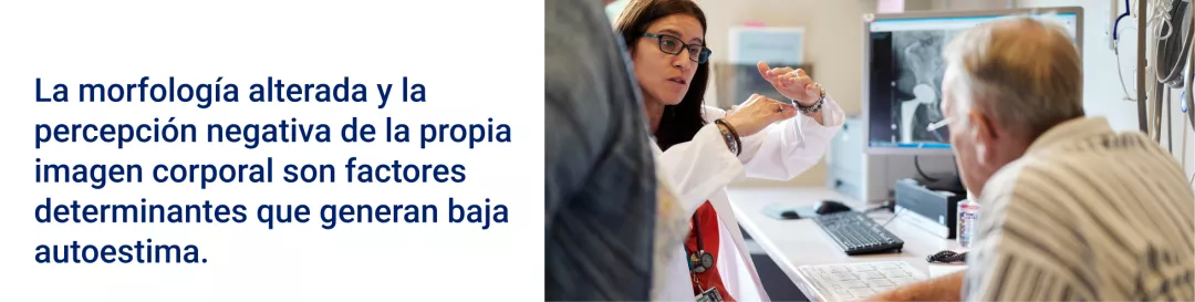 La morfología alterada y la percepción negativa de la propia imagen corporal son factores determinantes que generan baja autoestima.