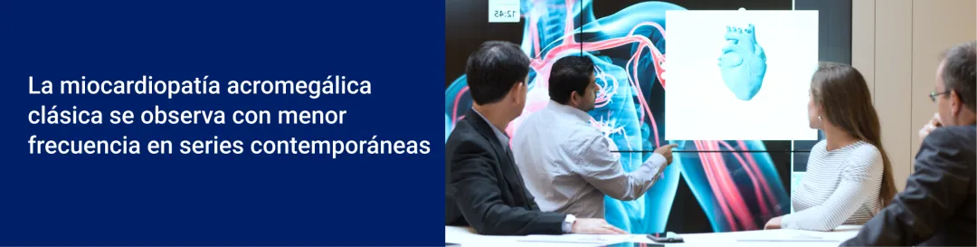 La miocardiopatía acromegálica clásica se observa con menor frecuencia en series contemporáneas