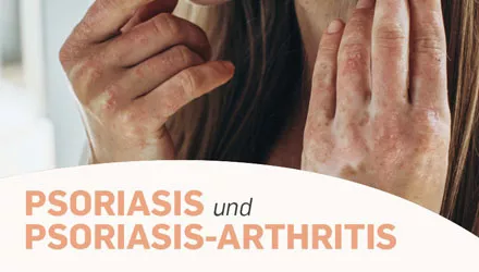 thumb-psoriasis-arthritis-broschuere