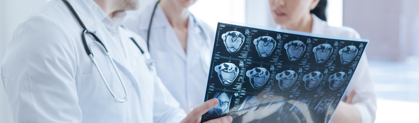 Doctor reviewing mri scan multiple sclerosis Doctor reviewing mri scan multiple sclerosis