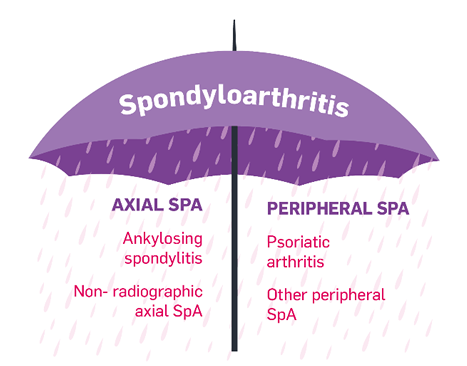 Infographic Spondyloarthritis Infographic Spondyloarthritis