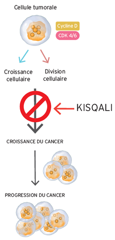 Infographic Kisqali Infographic Kisqali