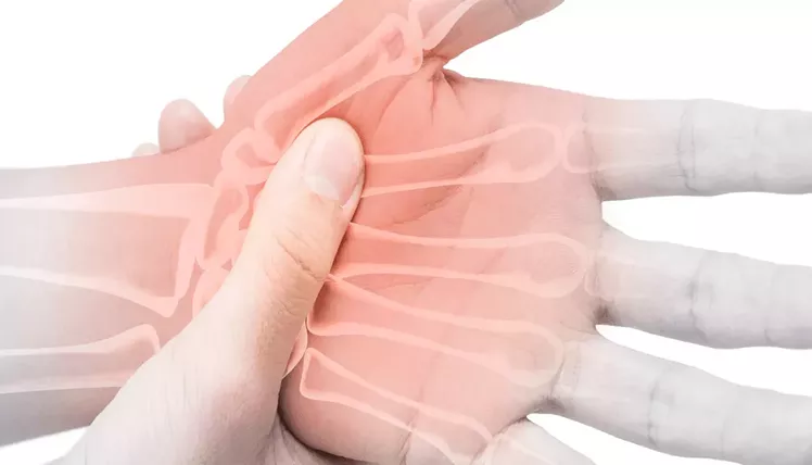 Illustration of a painful hand