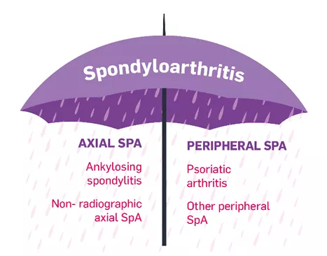 Infographic Spondyloarthritis