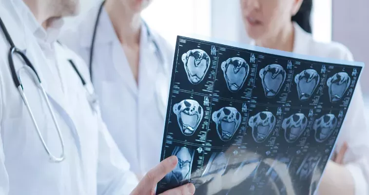 Doctors examining a MRI scan