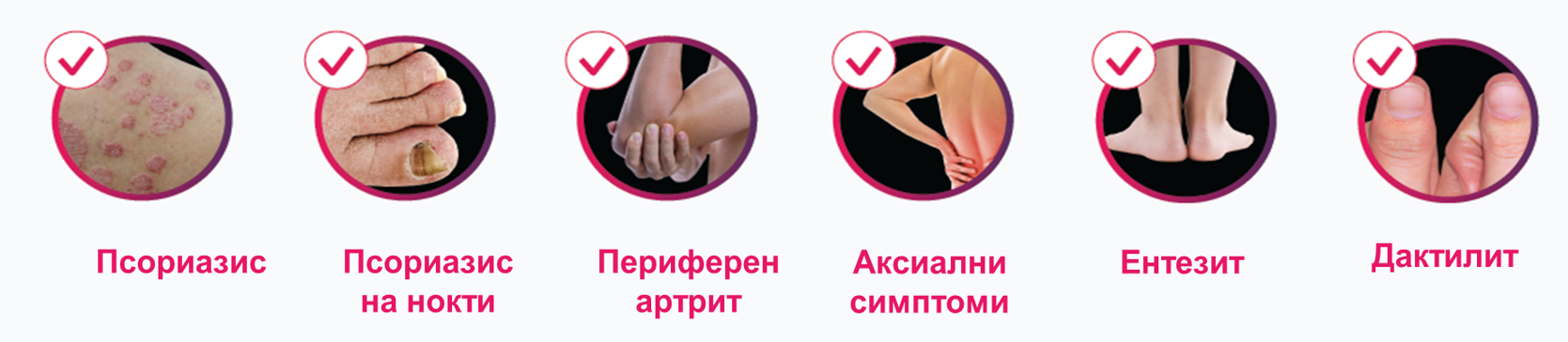 Cosentyx - Псориатричен артрит банер Cosentyx - Псориатричен артрит банер