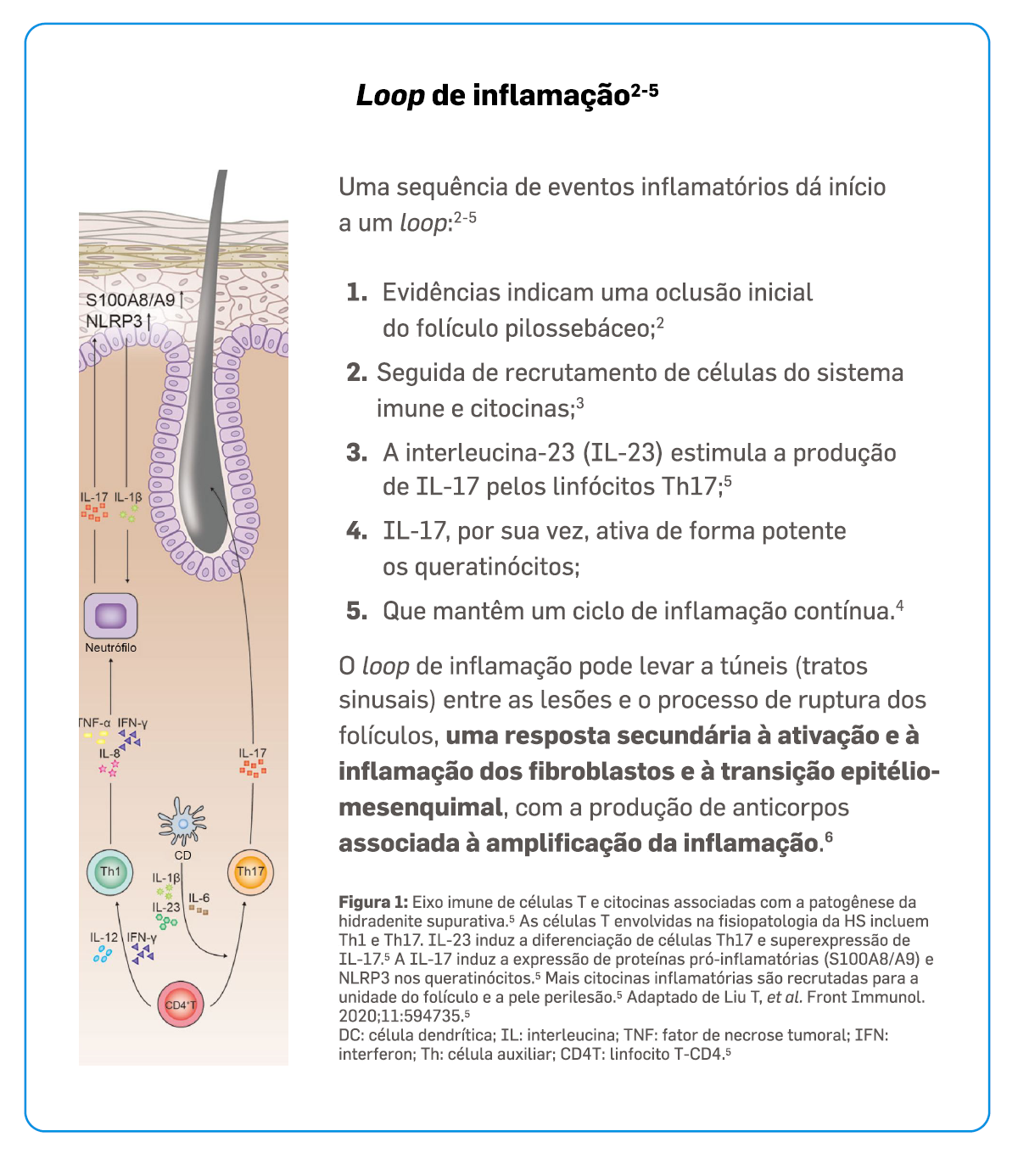 cosentyx-desvendando-fisiopatologia-hs