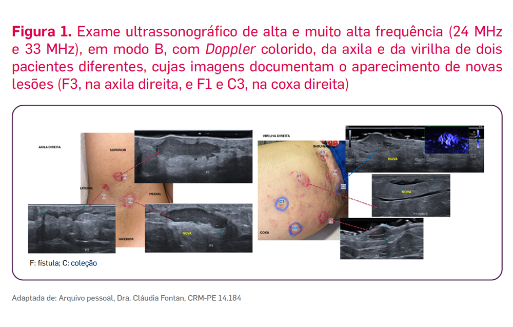 img-consentyx-hs-ultrassonografia-1