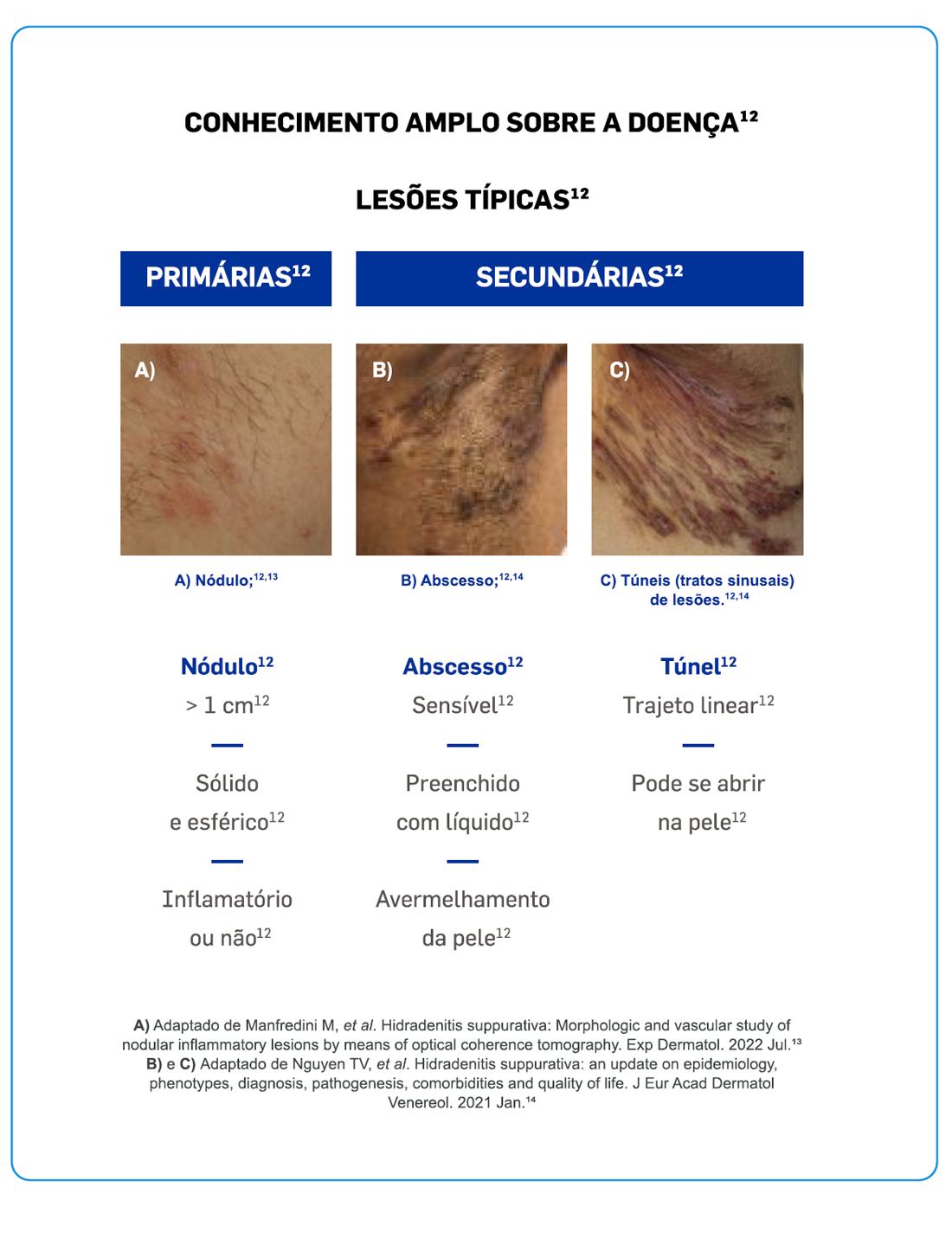 img-cosentyx-hs-burden-grafico2 img-cosentyx-hs-burden-grafico2