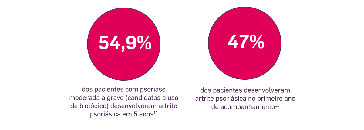 img-evitar-progressao-psoriase-para-atrite-psoriasica04 img-evitar-progressao-psoriase-para-atrite-psoriasica04