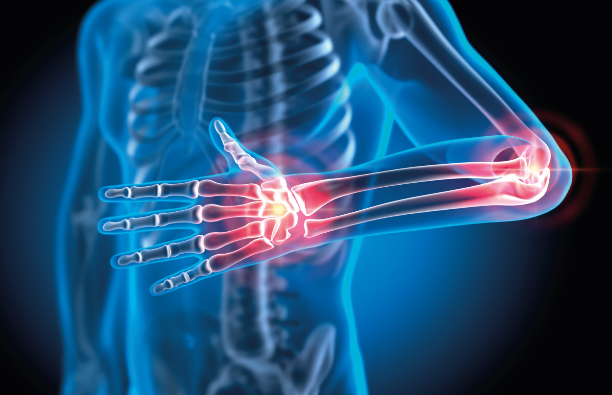 img-grappa-artrite-psoriasica-topo