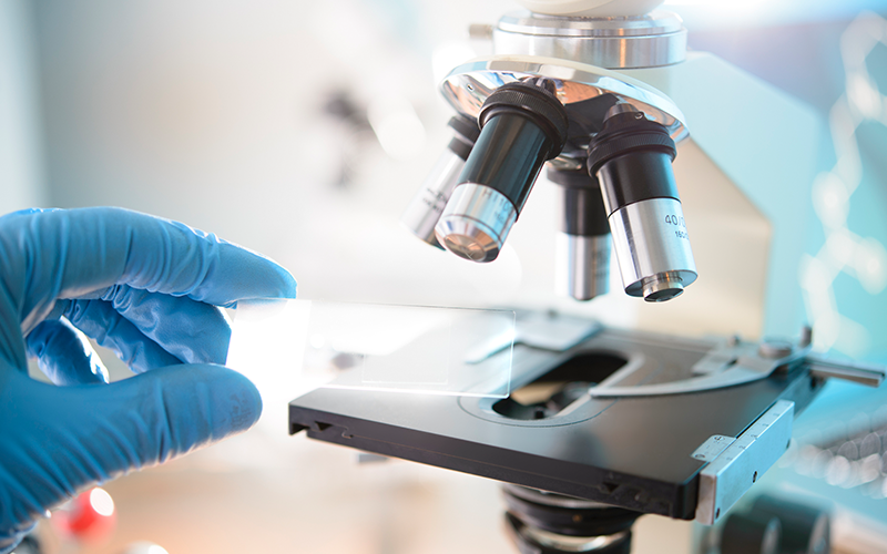 img-cosentyx-resposta-clinica-reversao-molecular-topo