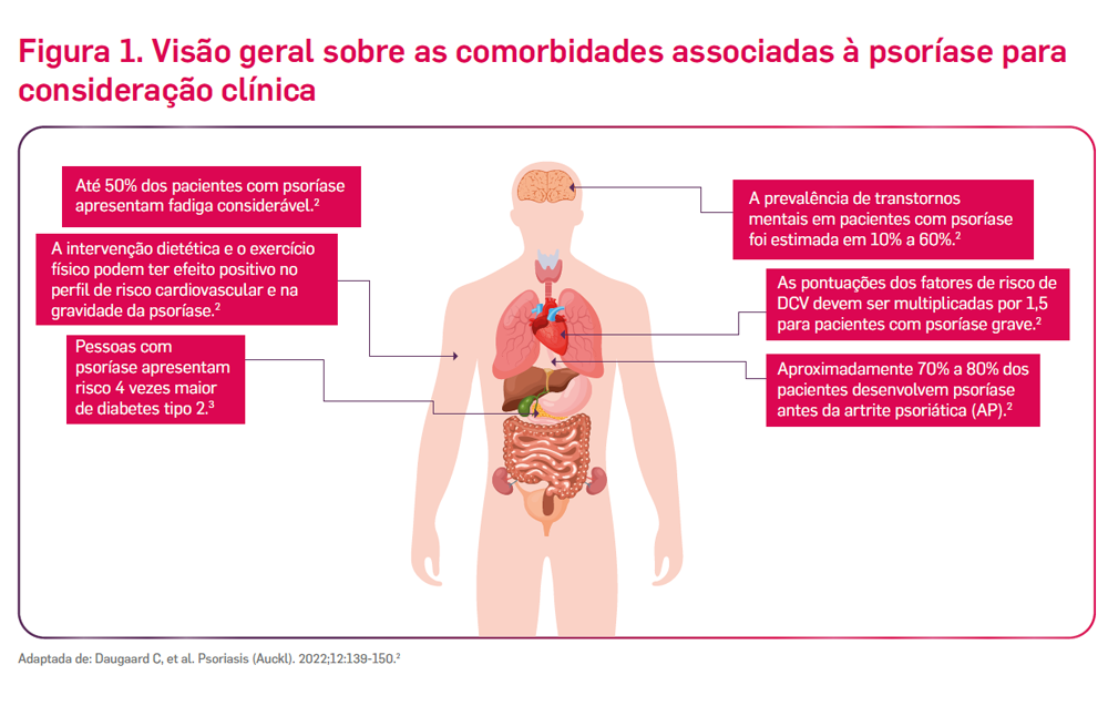 img-derma-cosentyx-alem-pele-1