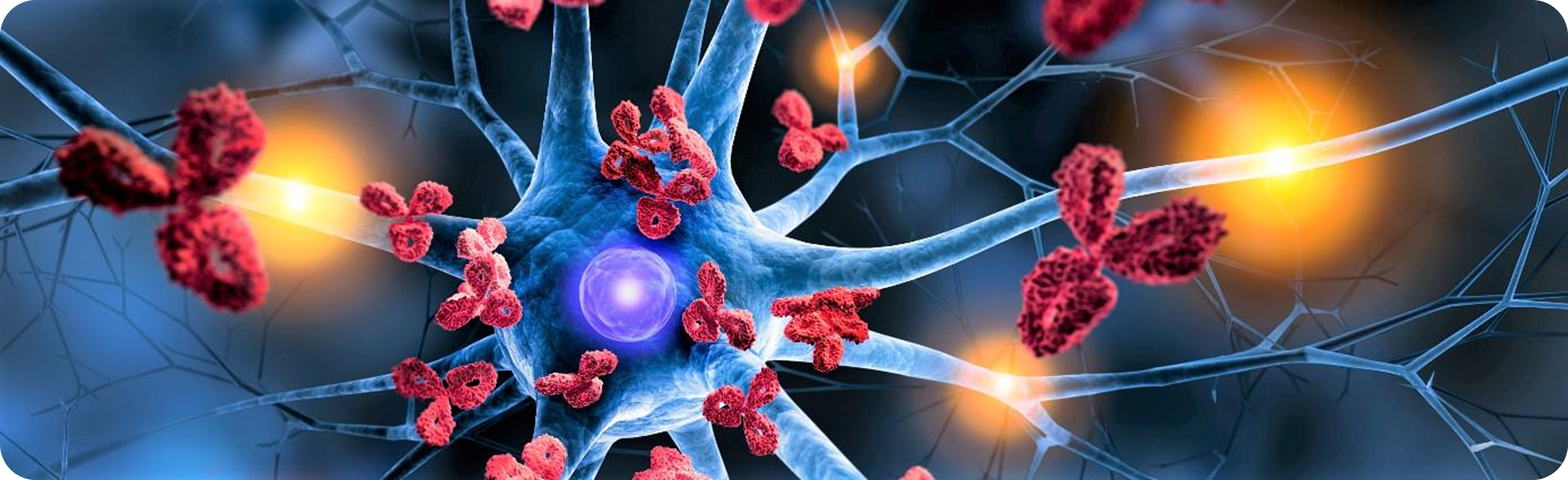 Multiple Sklerose (MS) Multiple Sklerose (MS)