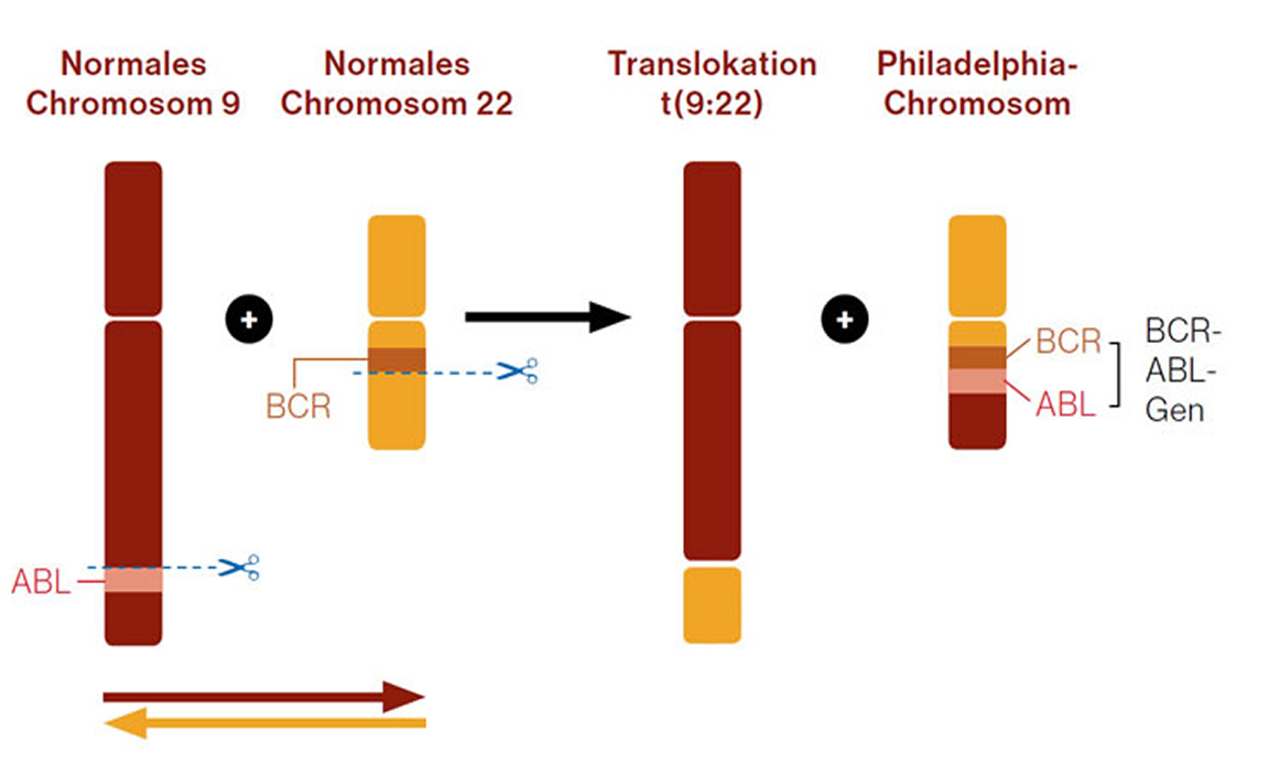 Abbildung 3: Chromosomentranslokation bei der CML