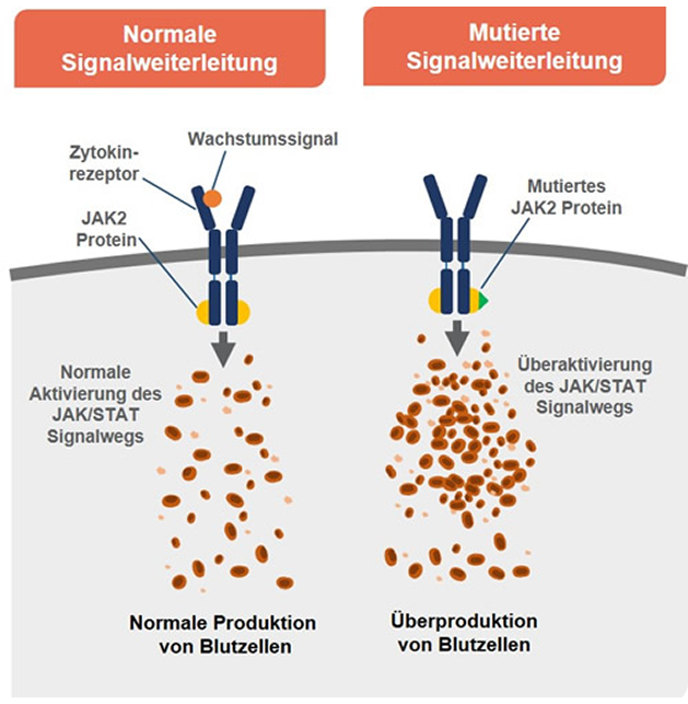 mutationen_in_JAK2