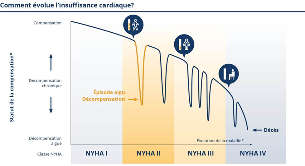 Comment evolue linsuffisance cardiaque Comment evolue linsuffisance cardiaque