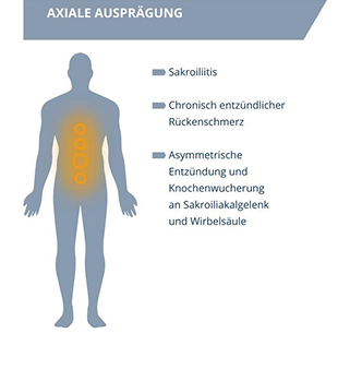 axiale axiale