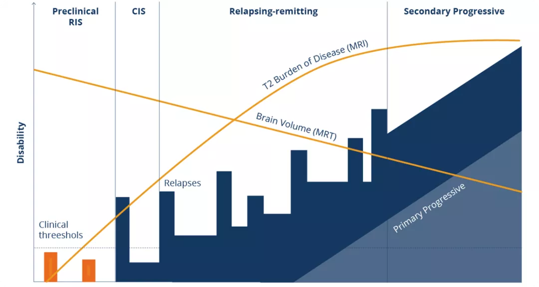 Die verschiedenen Formen und Stadien der MS