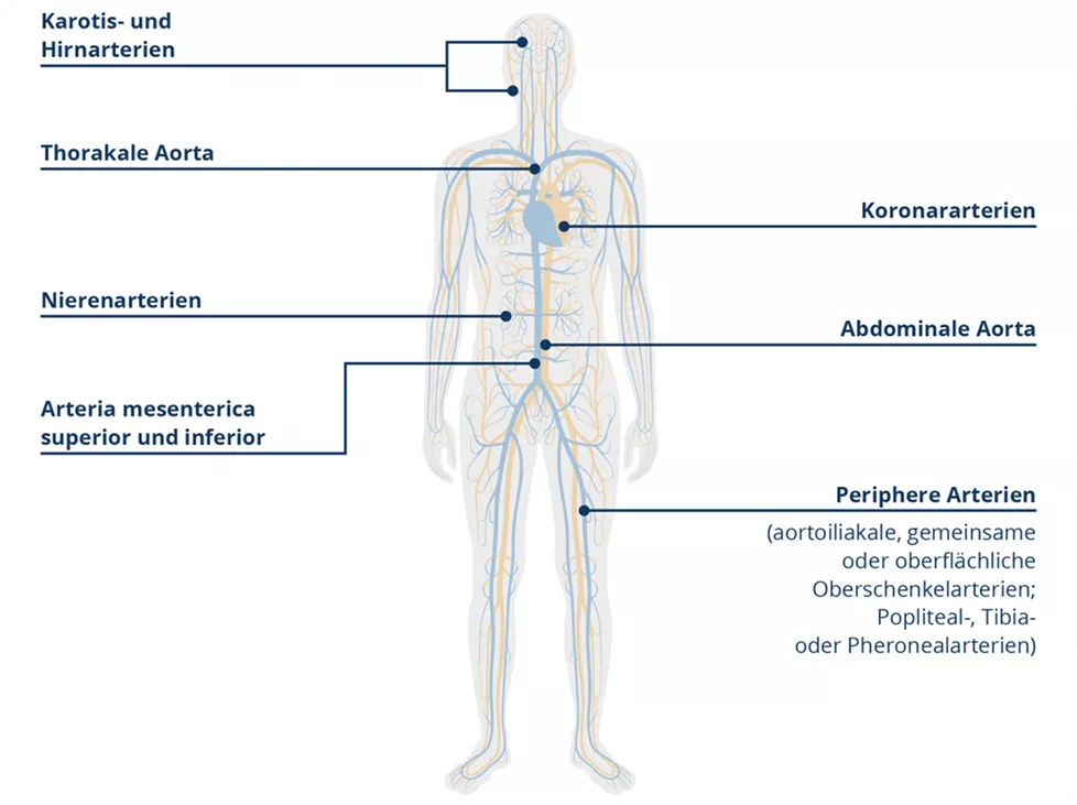 Manifestationen_der_Herz_Kreislauf_Erkrankungen