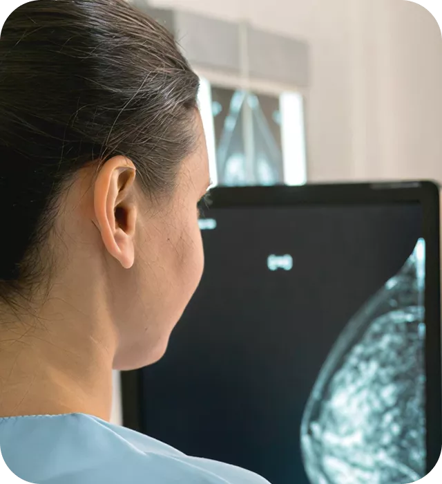 Pathophysiologie_des_Mammakarzinoms_mob