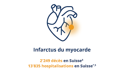 Infarctus Infarctus