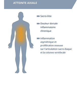 ATTEINTE_AXIALE ATTEINTE_AXIALE