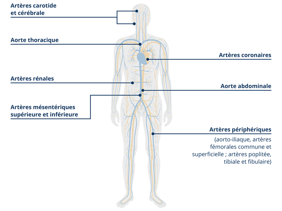 Manifestations des maladies cardiovasculaires Manifestations des maladies cardiovasculaires