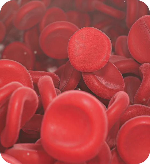 Polycythaemia_vera_mob