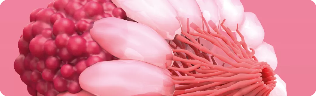 Brustkrebs: Eine vielschichtige Erkrankung