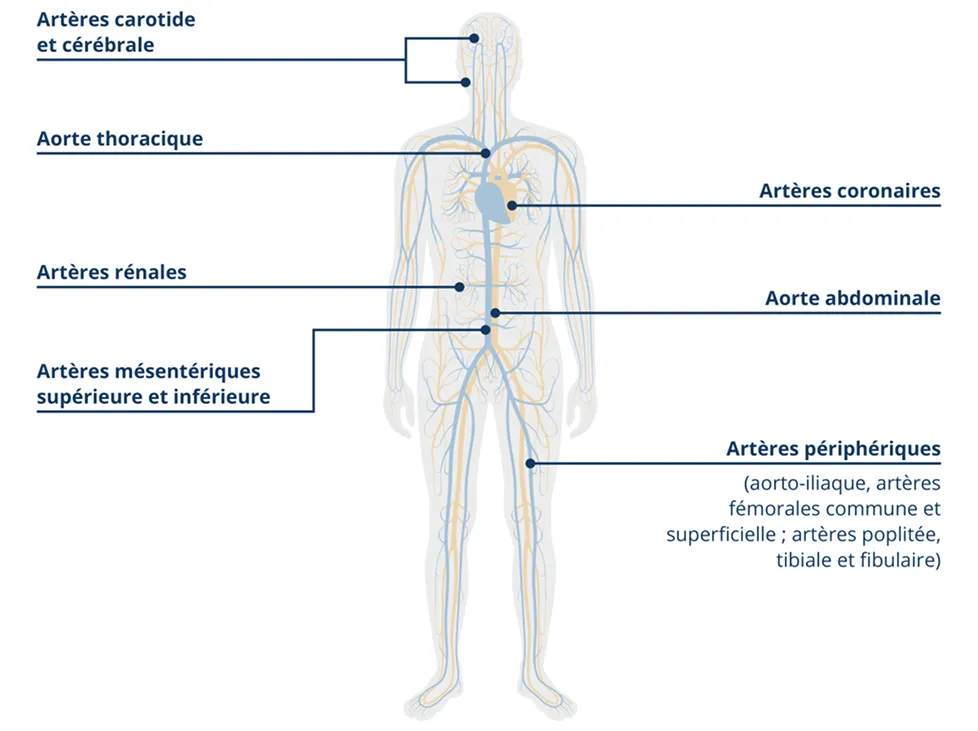 Manifestations des maladies cardiovasculaires