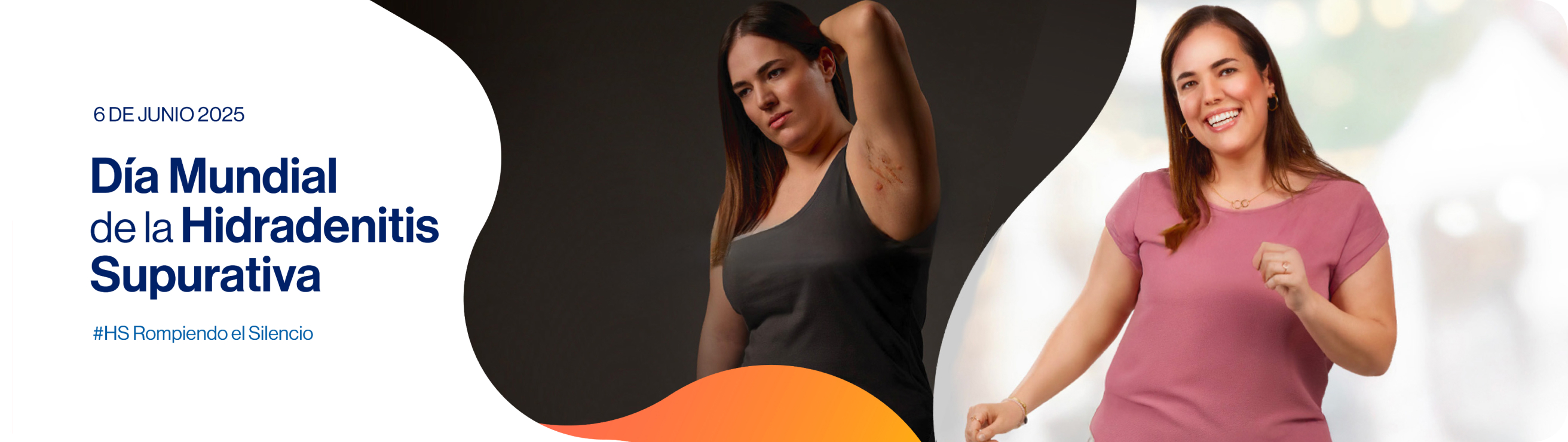 Banner_Hs_Hidradenitis_Supurativa Banner_Hs_Hidradenitis_Supurativa