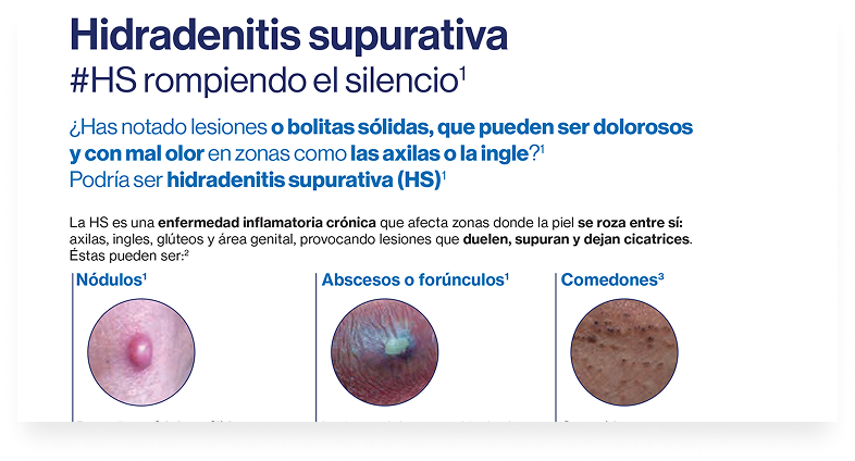 HS_Mitos_Y_Realidades HS_Mitos_Y_Realidades