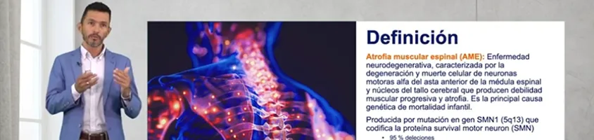 Qué es AME y la Carga de la Atrofia Muscular Espinal 