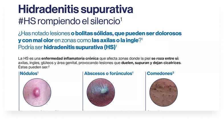 HS_Mitos_Y_Realidades