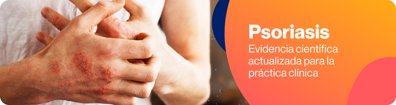 banner psoriasis