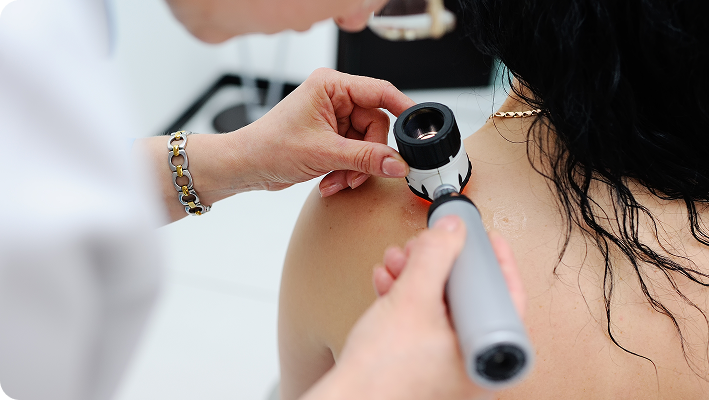 Hidradenitis Control Hidradenitis Control