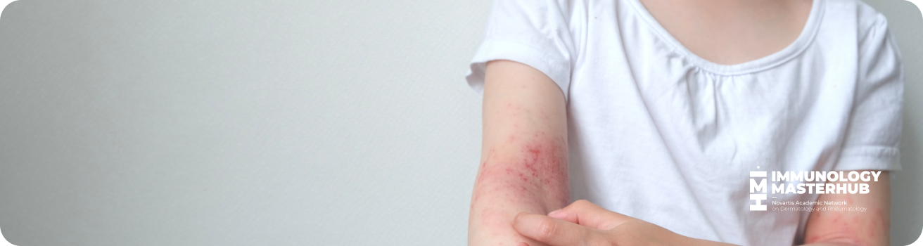 Banner2Psoriasis2025 Banner2Psoriasis2025